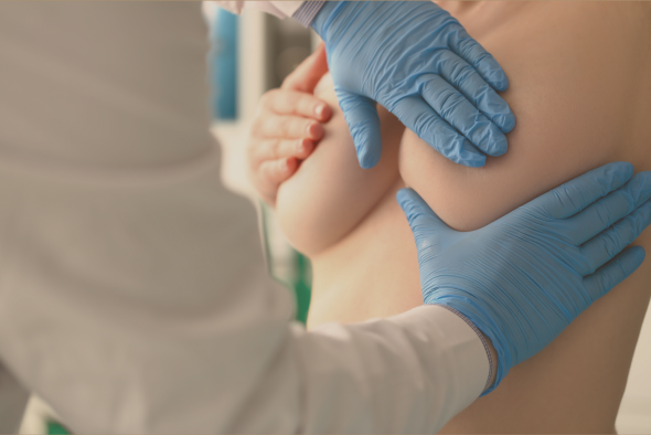 Mamoplastia Redutora: Como é feita, resultados e cicatriz - Dr. Felipe  Bicudo